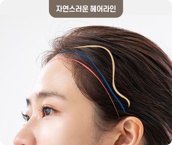 자연스러운 헤어라인