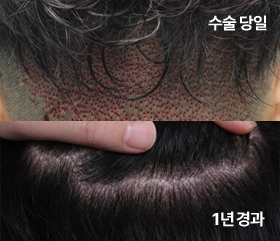 투블럭컷