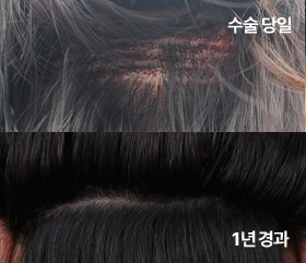 라인컷